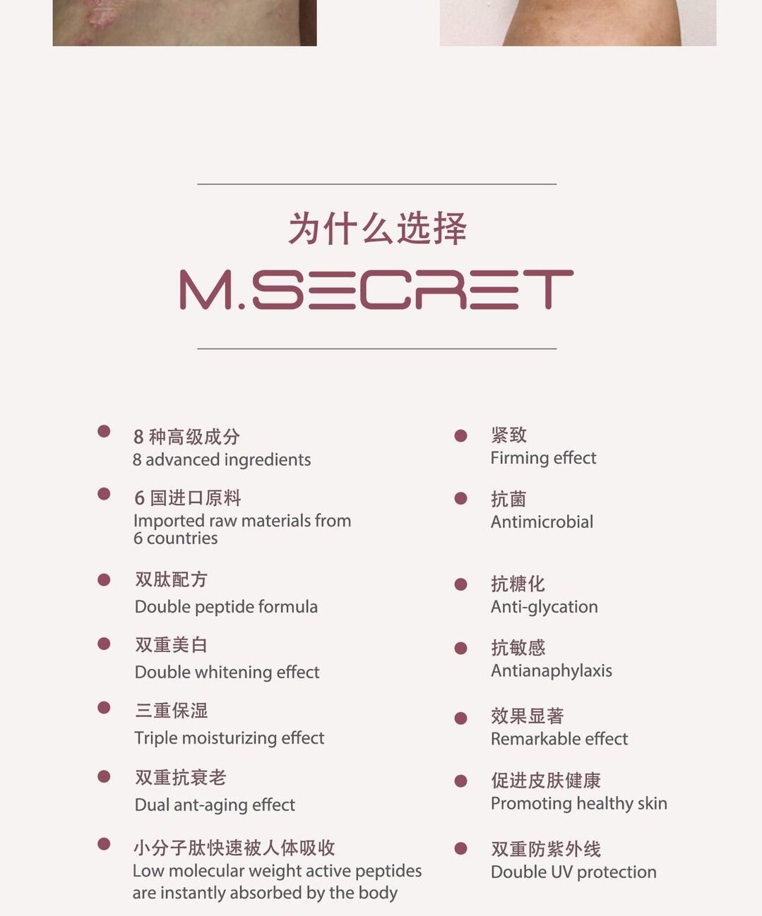 M.Secret 10